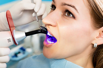 Advanced Dental Care | Intraoral Camera, Implant Restorations and Inlays  amp  Onlays