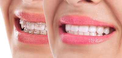 Advanced Dental Care | Teeth Whitening, Intraoral Camera and Periodontal Treatment