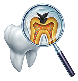 Advanced Dental Care | Dental Cleanings, Sinus Lift and Implant Restorations