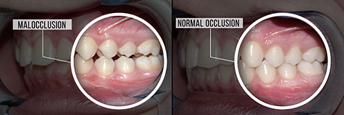 Advanced Dental Care | Periodontal Treatment, Dental Fillings and Sinus Lift