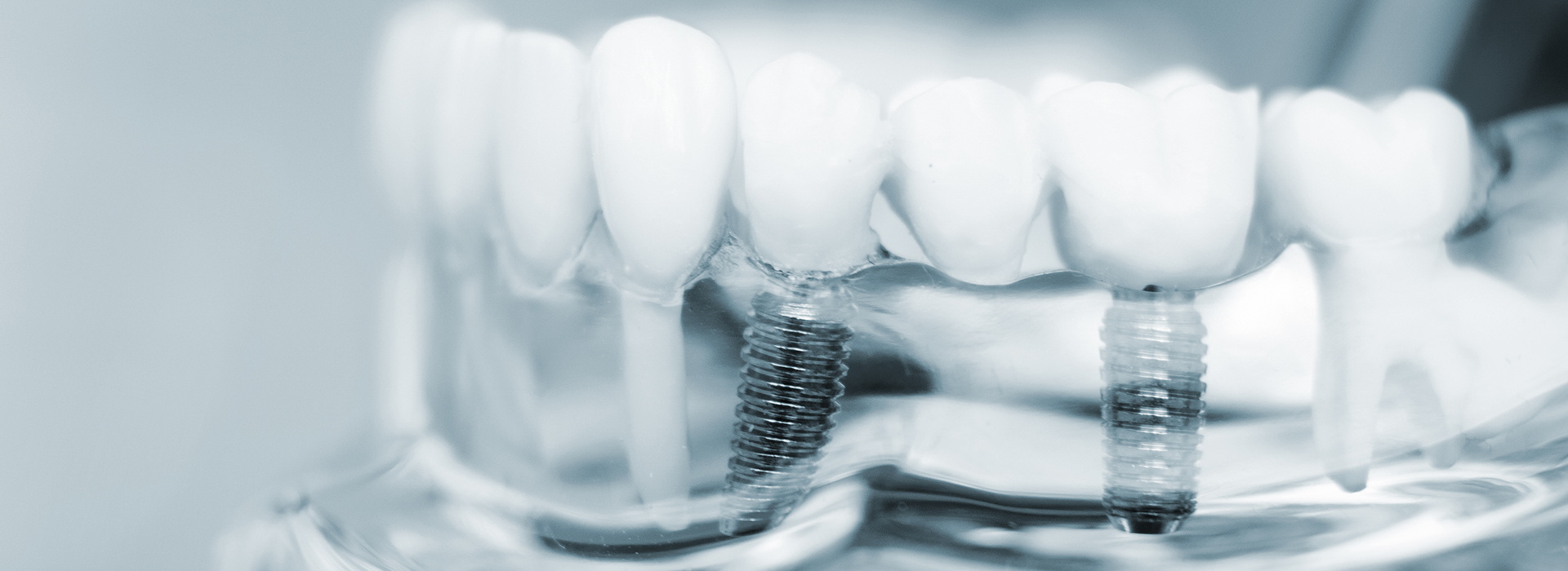 Advanced Dental Care | Preventative Program, Sedation Dentistry and Dental Fillings