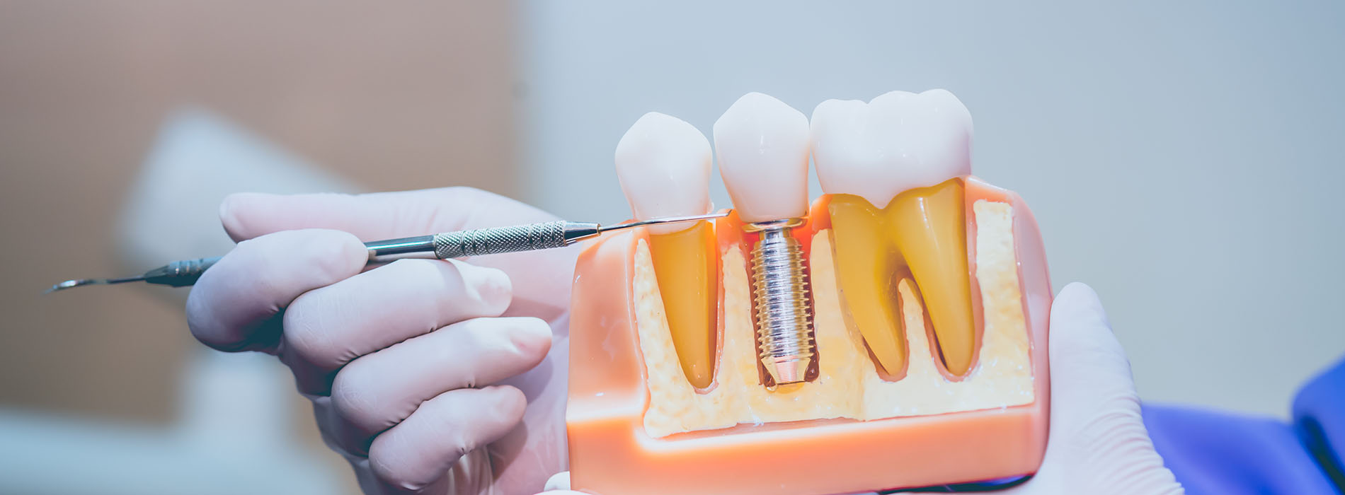 Advanced Dental Care | Periodontal Treatment, Implant Restorations and Digital Radiography