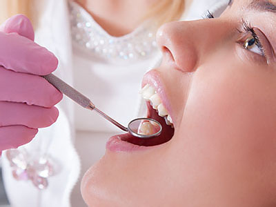 Advanced Dental Care | Teeth Whitening, Preventative Program and Inlays  amp  Onlays